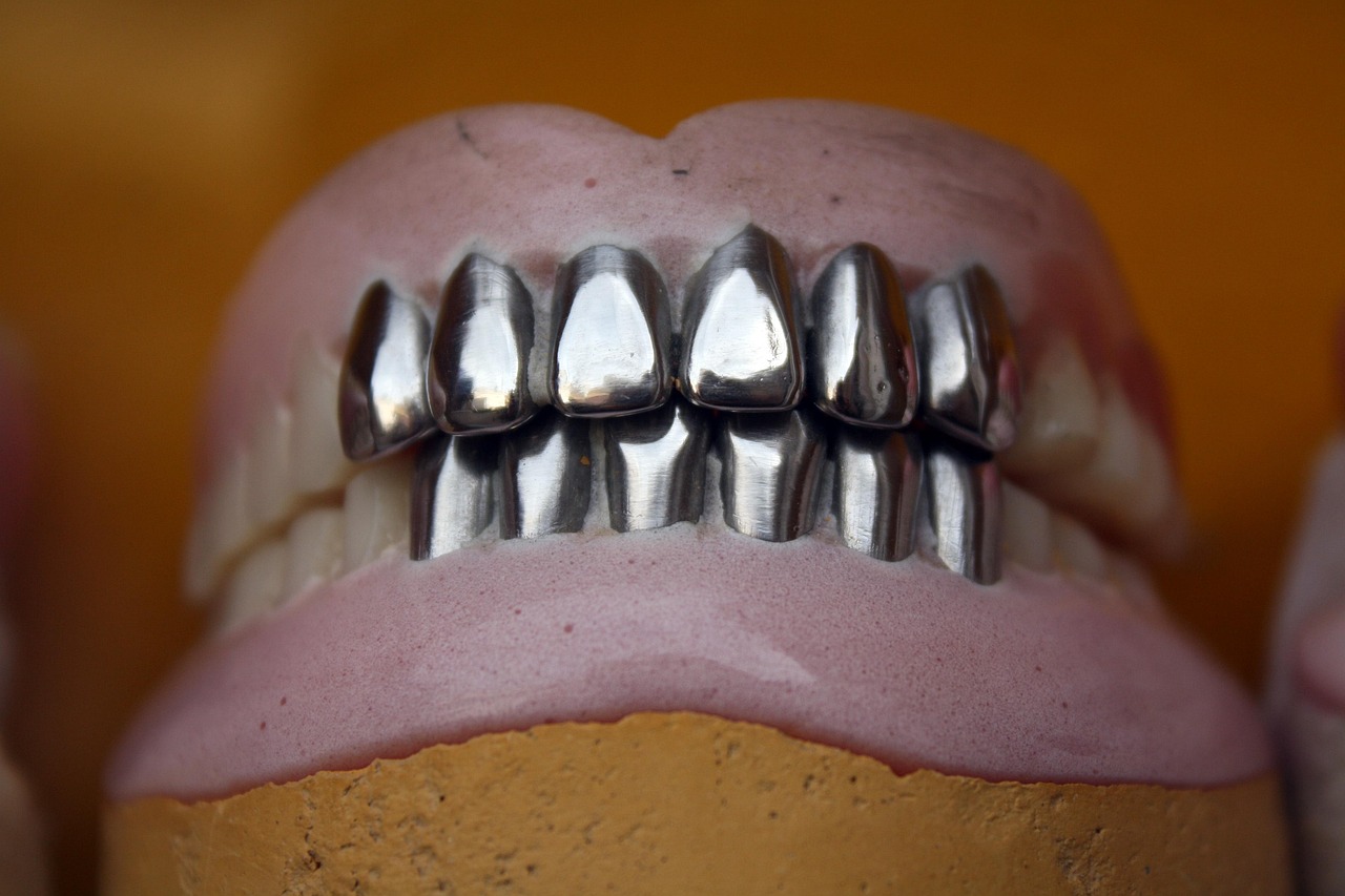 All on 4 vs all on 6 implants - Featured