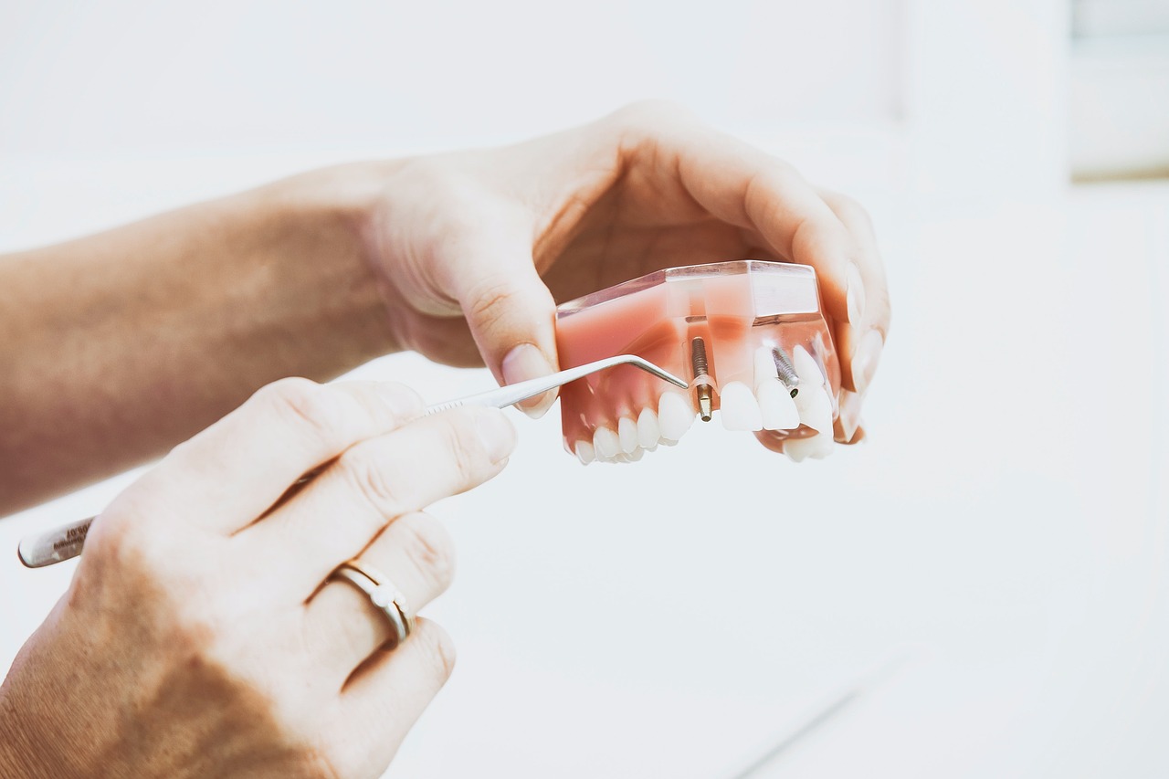 What is a dental emergency - Featured